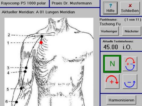 biorezonancia, biorezonancia Bratislava, diagnostika, parazity, bachova kvetová terapia, prístroje rayonex